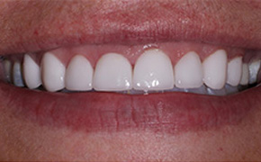 Fairfield Cosmetic Dentist