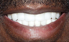 Family Dentist in Fairfield