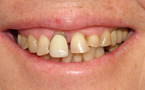 Fairfield Cosmetic Dentist